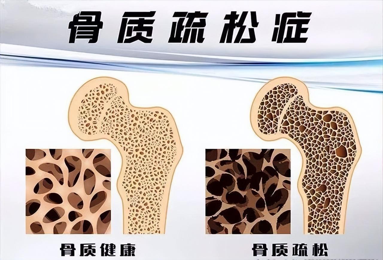 探索六味地黄丸的奥秘，传统中药中的健康宝藏五十多岁男人吃六味地黄丸好处